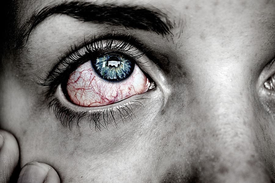 vivre avec une fibromyalgie
